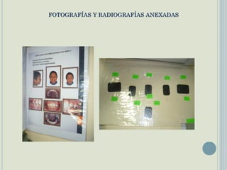 FOTOGRAFÍAS Y RADIOGRAFÍAS ANEXADAS
 