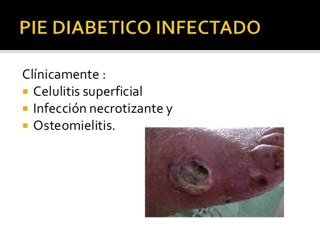 Caso clinico. pie diabetico Caso clinico. pie diabetico
