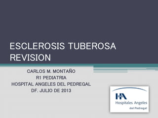 ESCLEROSIS TUBEROSA
REVISION
CARLOS M. MONTAÑO
R1 PEDIATRIA
HOSPITAL ANGELES DEL PEDREGAL
DF. JULIO DE 2013
 
