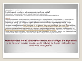 Osteoporosis no es contraindicación para cirugía de implantes
 si se hace un preciso análisis de la calidad de hueso realizados por
                       medio de tomografías.
 