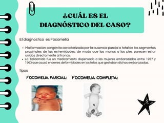 Focomelia Rx CASO CLINICO DE EMBRIOLOGIA PATOLOGIA DE MIEMBROS INFERIORES | PDF
