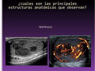 ¿cuales son las principales estructuras anatómicas que observan? TESTÍCULO 