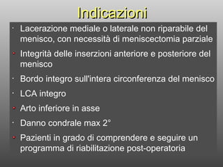 Indicazioni Lacerazione mediale o laterale non riparabile del menisco, con necessità di meniscectomia parziale Integrità delle inserzioni anteriore e posteriore del menisco  Bordo integro sull'intera circonferenza del menisco LCA integro Arto inferiore in asse Danno condrale max 2° Pazienti in grado di comprendere e seguire un programma di riabilitazione post-operatoria 
