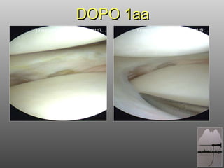 DOPO 1aa 
