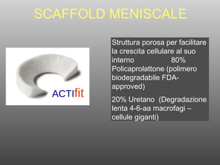 SCAFFOLD MENISCALE ACTI fit Struttura porosa per facilitare la crescita cellulare al suo interno  80% Policaprolattone (polimero biodegradabile FDA-approved) 20% Uretano  (Degradazione lenta 4-6-aa macrofagi – cellule giganti) 