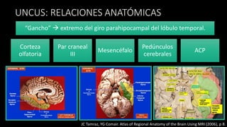 Caso clínico anestesia para tumores supratentoriales | PDF