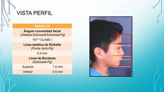 Caso clinico angel rmz | PPTX