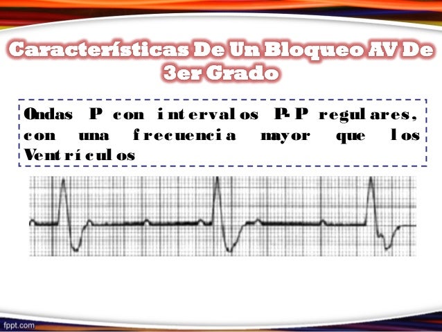 Bloqueo av avanzado pdf converter