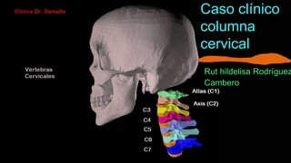 Caso clínico
columna
cervical
Rut hildelisa Rodríguez
Cambero
 