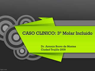 CASO CLINICO: 3° Molar Incluido

        Dr. Antonio Bravo de Montes
        Ciudad Trujillo 2009
 