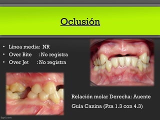 Oclusión

• Línea media: NR
• Over Bite : No registra
• Over Jet : No registra




                            Relación molar Derecha: Auente
                            Guía Canina (Pza 1.3 con 4.3)
 