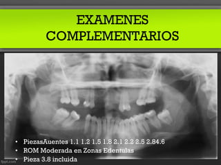 EXAMENES
          COMPLEMENTARIOS




• PiezasAuentes 1.1 1.2 1.5 1.8 2.1 2.2 2.5 2.84.6
• ROM Moderada en Zonas Edentulas
• Pieza 3.8 incluida
 