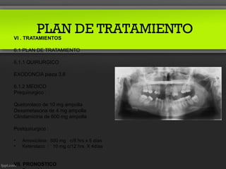 PLAN DE TRATAMIENTO
VI . TRATAMIENTOS

6.1 PLAN DE TRATAMIENTO

6.1.1 QUIRURGICO

EXODONCIA pieza 3.8

6.1.2 MEDICO
Prequirurgico :

Quetorolaco de 10 mg ampolla
Dexametasona de 4 mg ampolla
Clindamicina de 600 mg ampolla

Postquirurgico :

•   Amoxicilina: 500 mg c/8 hrs x 5 días
•   Keterolaco : 10 mg c/12 hrs. X 4días


VII. PRONOSTICO
 