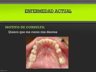 ENFERMEDAD ACTUAL


MOTIVO DE CONSULTA:
 Quiero que me curen mis dientes
 