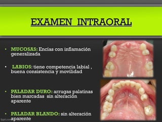 EXAMEN INTRAORAL

• MUCOSAS: Encías con inflamación
  generalizada

•   LABIOS: tiene competencia labial ,
    buena consistencia y movilidad



• PALADAR DURO: arrugas palatinas
  bien marcadas sin alteración
  aparente

• PALADAR BLANDO: sin alteración
  aparente
 