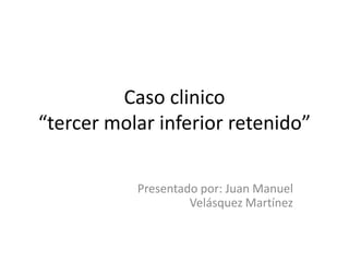Caso clinico
“tercer molar inferior retenido”

           Presentado por: Juan Manuel
                    Velásquez Martínez
 