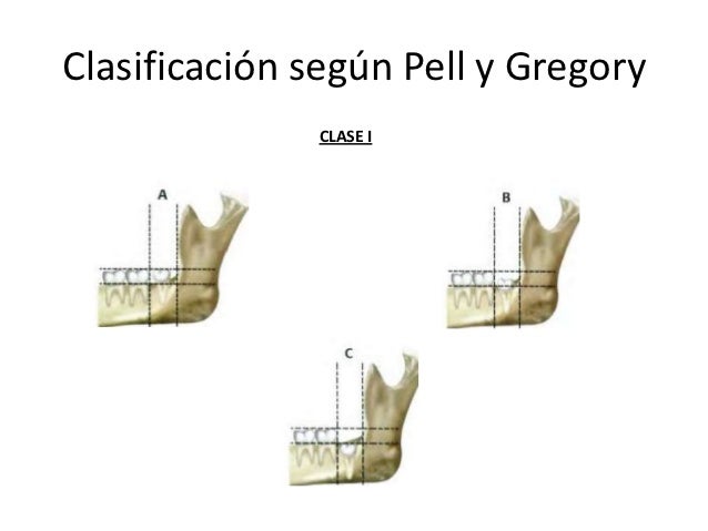Caso clinico clinica adulto2