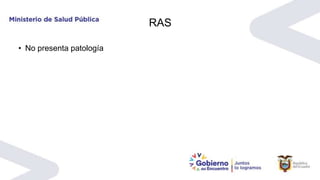 RAS
• No presenta patología
 