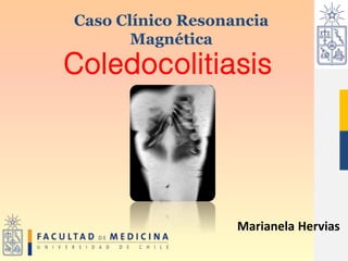 Coledocolitiasis
Caso Clínico Resonancia
Magnética
Marianela Hervias
 