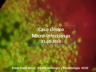 Caso clínico
Micro-infecciosas
31-05-2019
Pablo Fraile Ribot R4 Microbiología y Parasitología HUSE
 