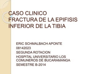 CASO CLINICO
FRACTURA DE LA EPIFISIS
INFERIOR DE LA TIBIA
ERIC SCHMALBACH APONTE
08142023
SEGUNDA ROTACION
HOSPITAL UNIVERSITARIO LOS
COMUNEROS DE BUCARAMANGA
SEMESTRE B-2014
 