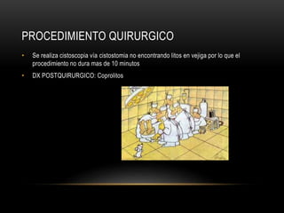 PROCEDIMIENTO QUIRURGICO
• Se realiza cistoscopia vía cistostomia no encontrando litos en vejiga por lo que el
procedimiento no dura mas de 10 minutos
• DX POSTQUIRURGICO: Coprolitos
 