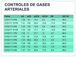 CONTROLES DE GASES
ARTERIALES
Fecha pH pO2 pCO2 HCO3 EB SAT 02
31/01/17 9 PM 7,26 141 14,3 6,3 -19,4 98,3
31/01/17 10 PM 7,31 130 25,6 12,6 -11,9 98,5
01/02/17 8 AM 7,22 132 14,9 5,9 -20,6 98,2
01/02/17 10 AM 7,33 122 17,7 9,1 -15,2 98,5
01/02/17 1 PM 7,35 11 27,7 15 -8,7 98,4
01/02/17 3 PM 7,32 94 31,6 15,8 -8,7 96,5
01/02/17 5 PM 7,34 98,5 28,6 15,1 -8,9 97,4
01/02/17 9 PM 7,39 105 31,7 19,2 -4,3 98,3
02/02/17 2 AM 7,34 112 30,6 16,3 -7,9 98,3
02/02/17 6 AM 7,37 113 30,6 17,5 -6,2 98,4
 