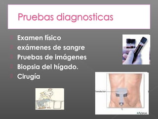   Examen físico
   exámenes de sangre
   Pruebas de imágenes
   Biopsia del hígado.
   Cirugía
 