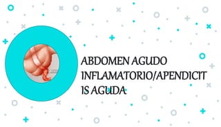 ABDOMEN AGUDO
INFLAMATORIO/APENDICIT
IS AGUDA
 