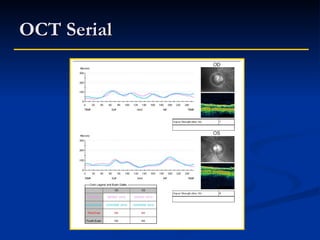 Oct Serial Raster Caso clinico glaucoma y refractiva | PPT