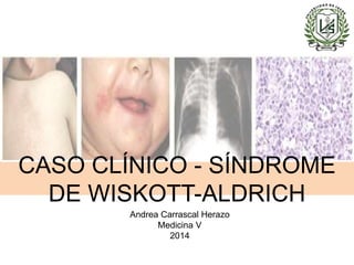 CASO CLÍNICO - SÍNDROME
DE WISKOTT-ALDRICH
Andrea Carrascal Herazo
Medicina V
2014
 