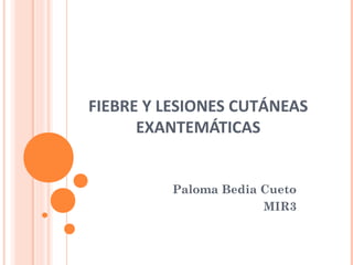 FIEBRE Y LESIONES CUTÁNEAS
EXANTEMÁTICAS
Paloma Bedia Cueto
MIR3
 