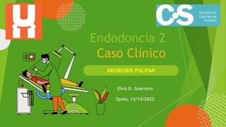 NECROSIS PULPAR
Endodoncia 2
Caso Clínico
Elvis D. Guerrero
Quito, 13/12/2022
 