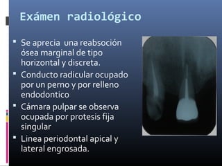 Exámen radiológico
 Se aprecia una reabsoción
ósea marginal de tipo
horizontal y discreta.
 Conducto radicular ocupado
por un perno y por relleno
endodontico
 Cámara pulpar se observa
ocupada por protesis fija
singular
 Linea periodontal apical y
lateral engrosada.
 
