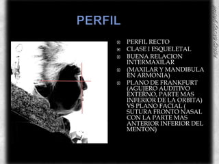 PERFIL	PERFIL RECTOCLASE I ESQUELETALBUENA RELACION INTERMAXILAR(MAXILAR Y MANDIBULA EN ARMONIA)PLANO DE FRANKFURT (AGUJERO AUDITIVO EXTERNO, PARTE MAS INFERIOR DE LA ORBITA) VS PLANO FACIAL ( SUTURA FRONTO NASAL CON LA PARTE MAS ANTERIOR INFERIOR DEL MENTON)