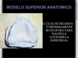MODELO SUPERIOR ANATOMICOEL CUAL SE DELIMITA Y PROXIMAMENTE SE OCUPARA PARA HACER LA CUCHARILLA INDIVIDUAL