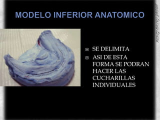 MODELO INFERIOR ANATOMICOSE DELIMITA  ASI DE ESTA FORMA SE PODRAN HACER LAS CUCHARILLAS INDIVIDUALES 
