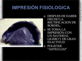 IMPRESIÓN FISIOLOGICADESPUES DE HABER HECHO LA RECTIFICACION DE BORDES,, SE TOMA LA IMPRESIÓN CON UN MATERIAL LIGERO Y DE GRAN EXACTITUDPOLIETER “IMPREGUM”