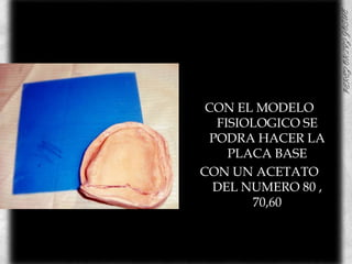 CON EL MODELO FISIOLOGICO SE PODRA HACER LA PLACA BASE CON UN ACETATO DEL NUMERO 80 , 70,60 