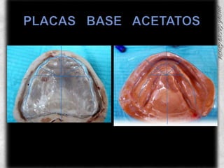 PLACAS   BASE   ACETATOS