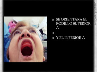 SE ORIENTARA EL RODILLO SUPERIOR  AY EL INFERIOR A