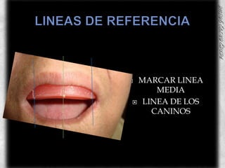 LINEAS DE REFERENCIAMARCAR LINEA MEDIALINEA DE LOS CANINOS