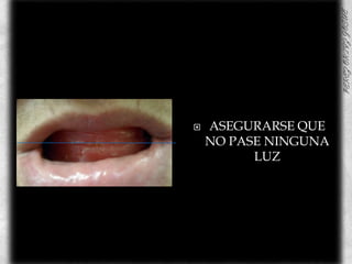 ASEGURARSE QUE NO PASE NINGUNA LUZ