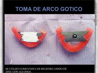 TOMA DE ARCO GOTICOSE UTILIZO COMO PASTA DE REGISTRO, OXIDO DE ZINC CON ALCOHOL