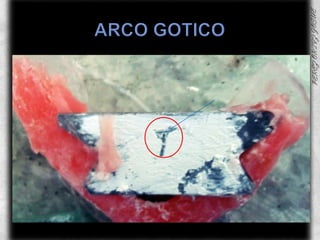 ARCO GOTICO