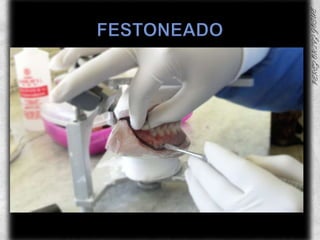 FESTONEADO