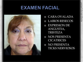 EXAMEN FACIAL	CARA OVALADA LABIOS RESECOSEXPRESION DE ANGUSTIA, TRISTEZANOS PRESENTA CICATRICESNO PRESENTA TICKS NERVIOSOS 