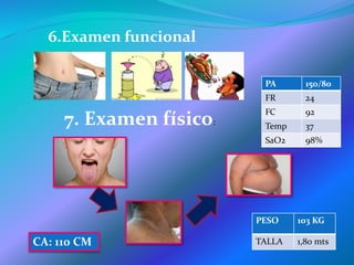 PA 150/80
FR 24
FC 92
Temp 37
SaO2 98%
PESO 103 KG
TALLA 1,80 mts
6.Examen funcional
7. Examen físico:
CA: 110 CM
 