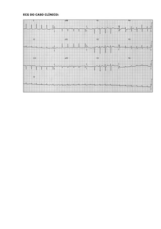 ECG DO CASO CLÍNICO:
 