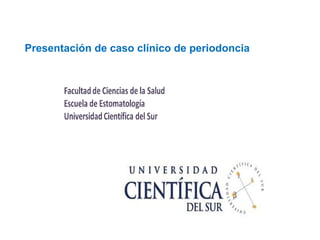 Presentación de caso clínico de periodoncia
 